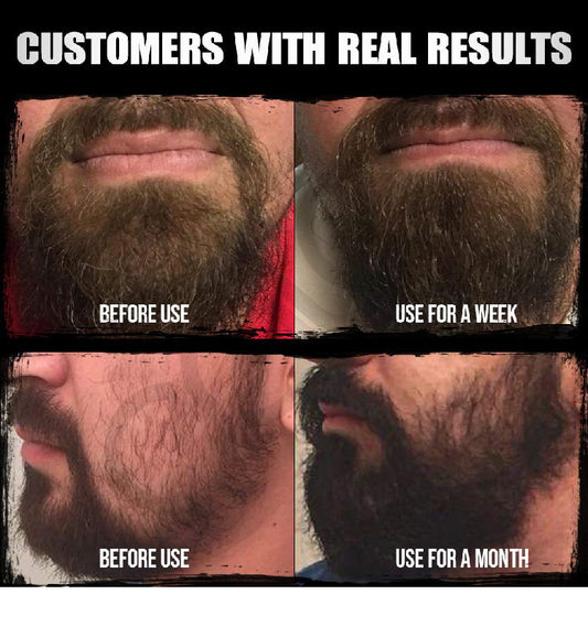 Beard Oil Mild Nourishing Beard Essential Oil 30ml