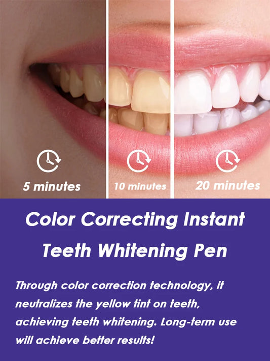 Instant Teeth Whitening Pen Cleaning Tooth Stain