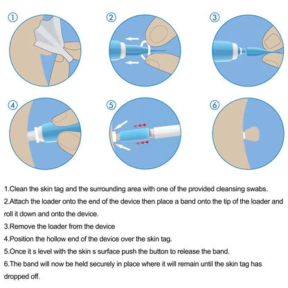 Remove Skin Tags To Remove Meat Ball Tool