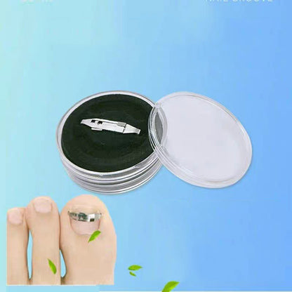 Orthognathic Buckle Nail Groove Ingrown Nail Correction Device