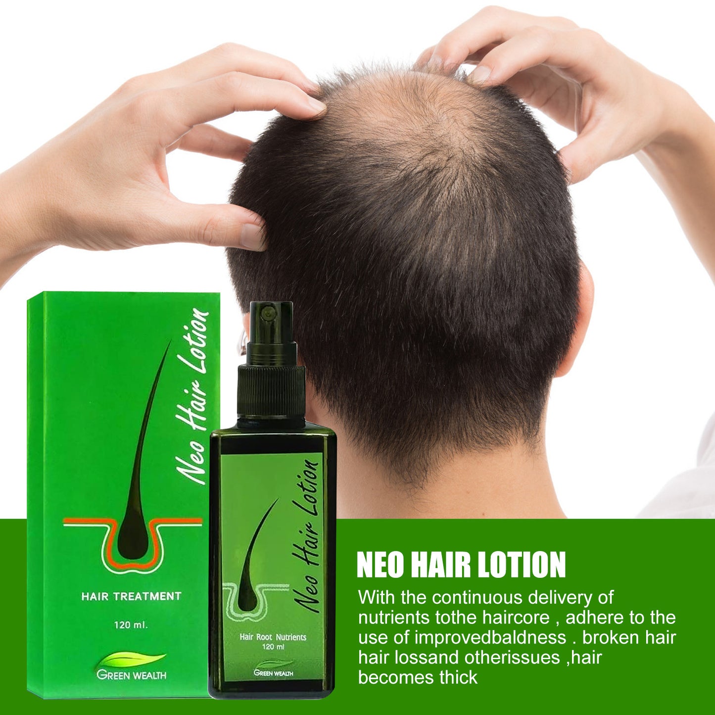 Hair Care Growth Lotion Spray