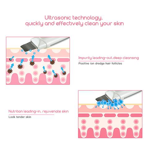 Ultrasonic Skin Scrubber Face Cleanser Blackhead Acne Removal