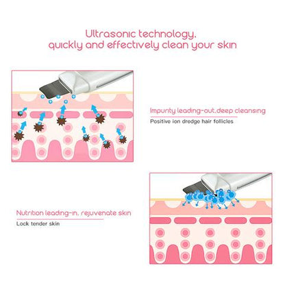 Ultrasonic Skin Scrubber Face Cleanser Blackhead Acne Removal