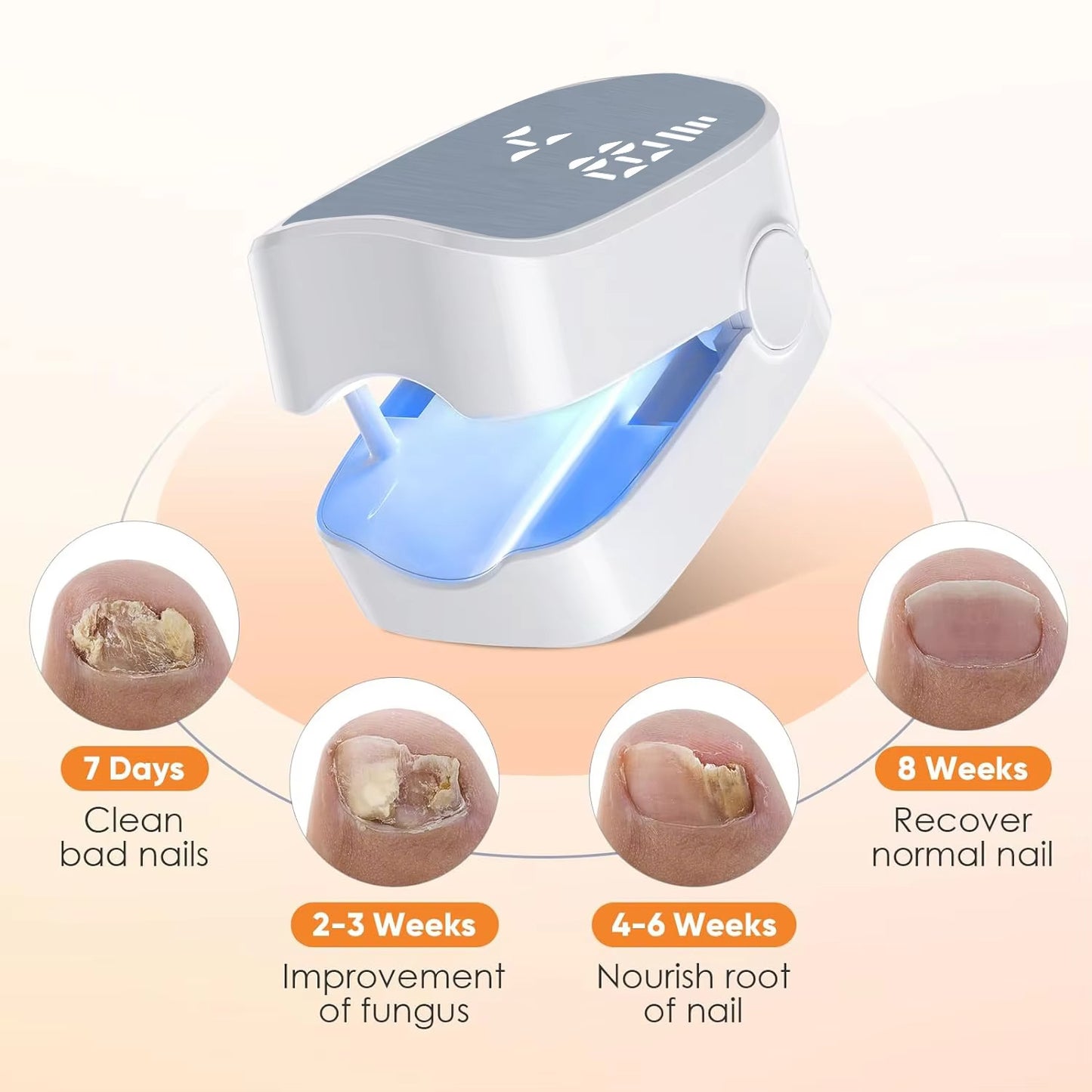 Nail Fungus Laser Treatment LED Light Device
