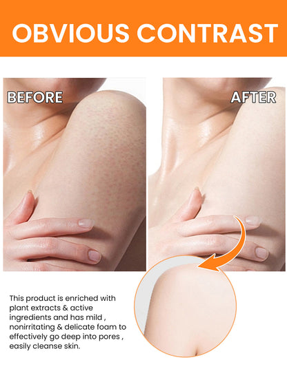 Turmeric Oil 30ml - For The Face Turmeric Serum For Dark Spots