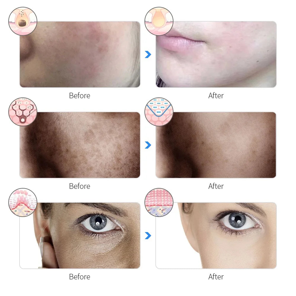 Rechargeable Facial LED Mask 7 Colors LED Photon Beauty Mask