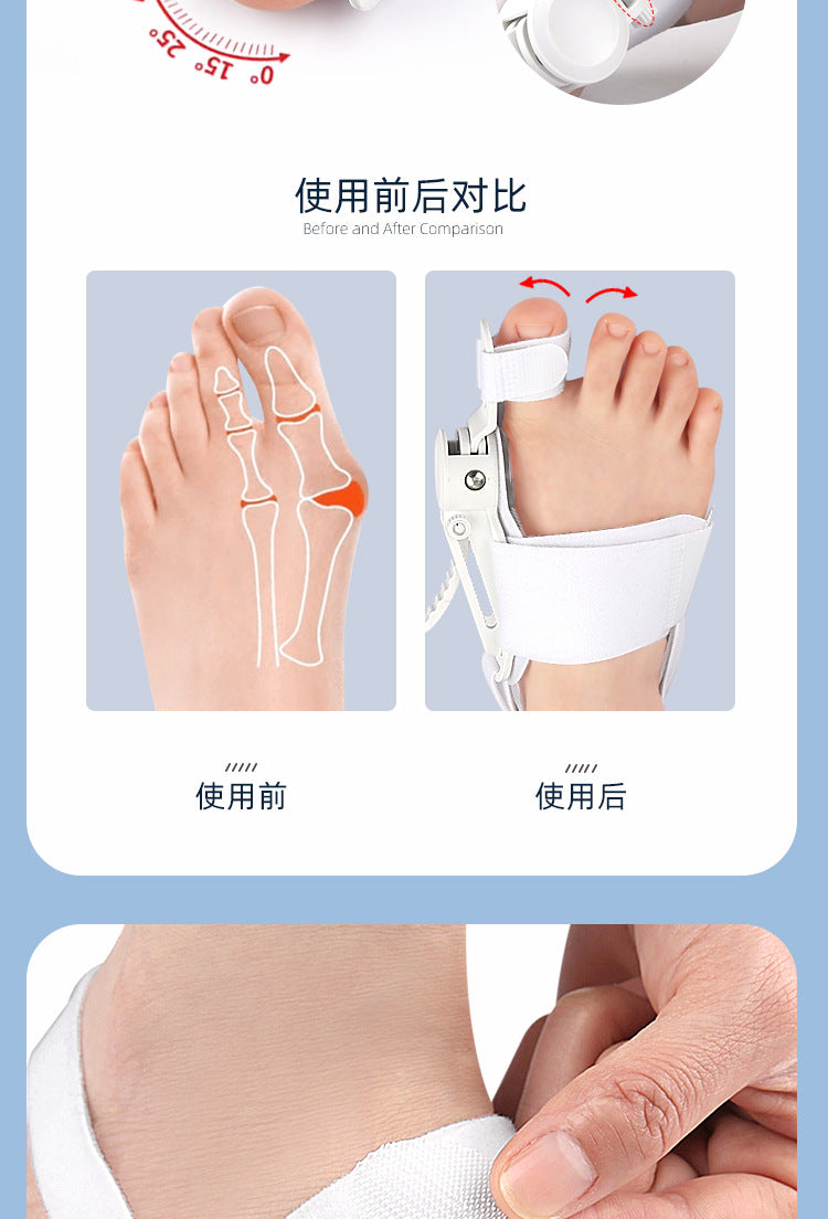 Hallux Valgus Corrector Bunions For Toes Corrector