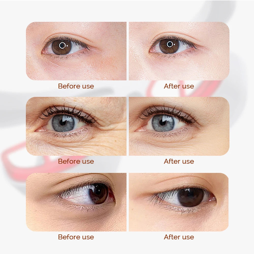 Electric Eye Massager Red Light Relieves Eye Fatigue