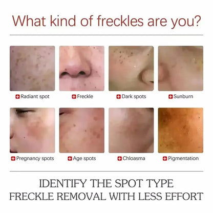 Powerful Spot-Removing Whiten Cream Brighten Skin