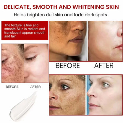 Powerful Spot-Removing Whiten Cream Brighten Skin