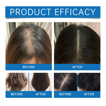 Rosemary Hair Serum Relax Scalp Stimulate Hair Growth