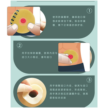 10PCS Ostomy Barrier Rings-Outer Diameter: