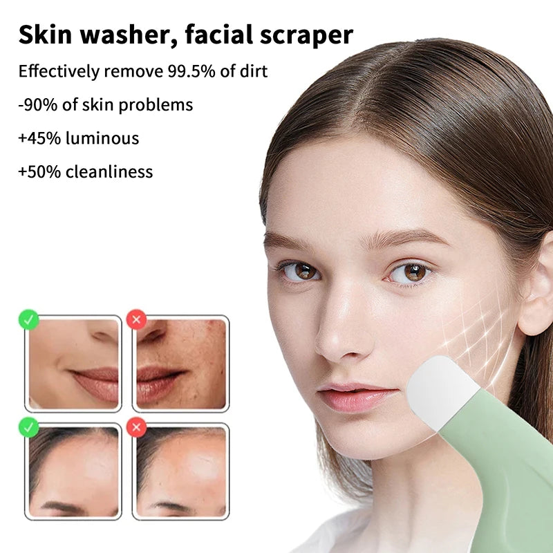 Face Spatula Nose Whitehead Remover Facial Blackhead Removal