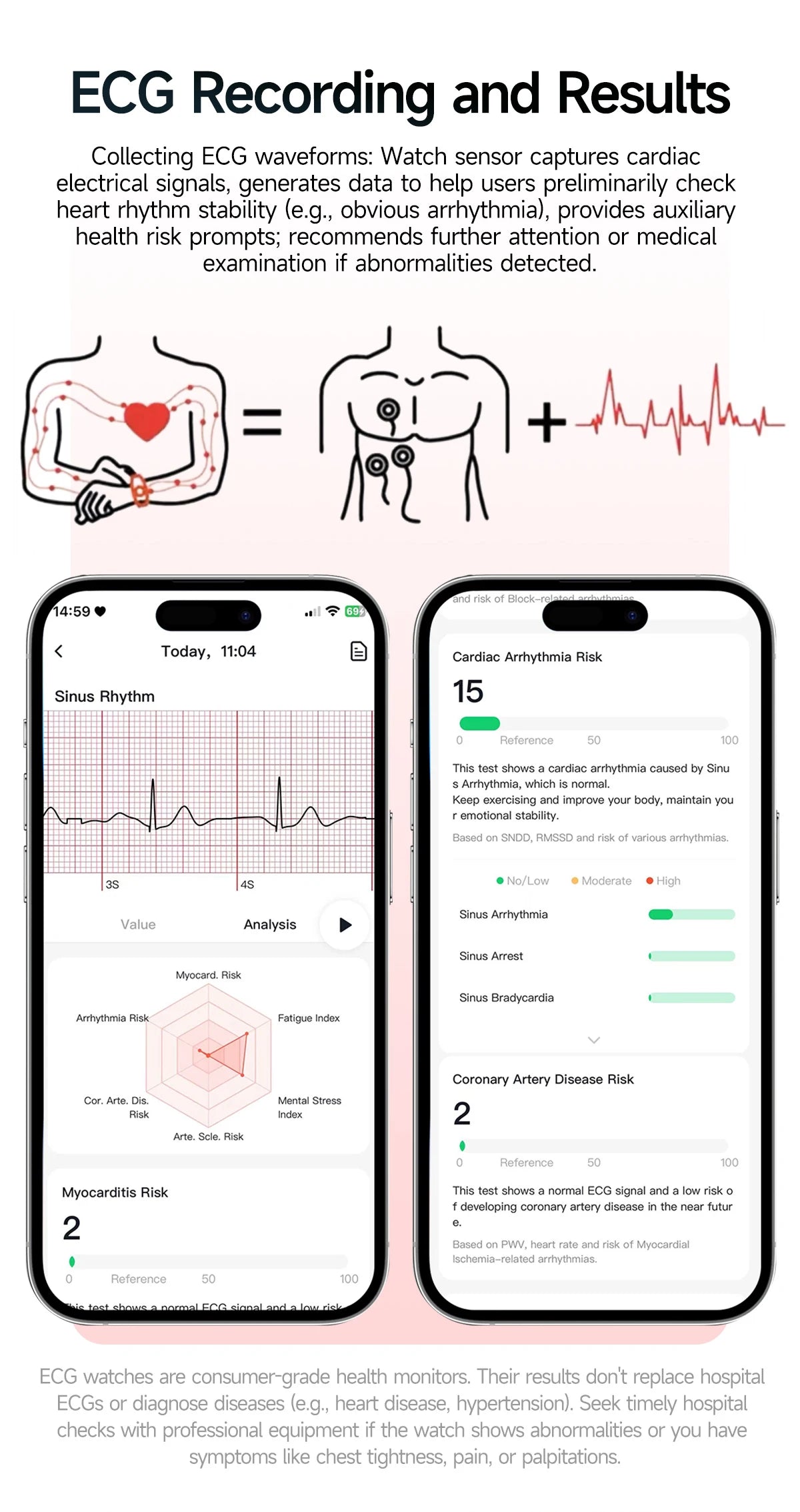 New ECG+PPG Smart Healthy Diagnosis Surveillance For Men