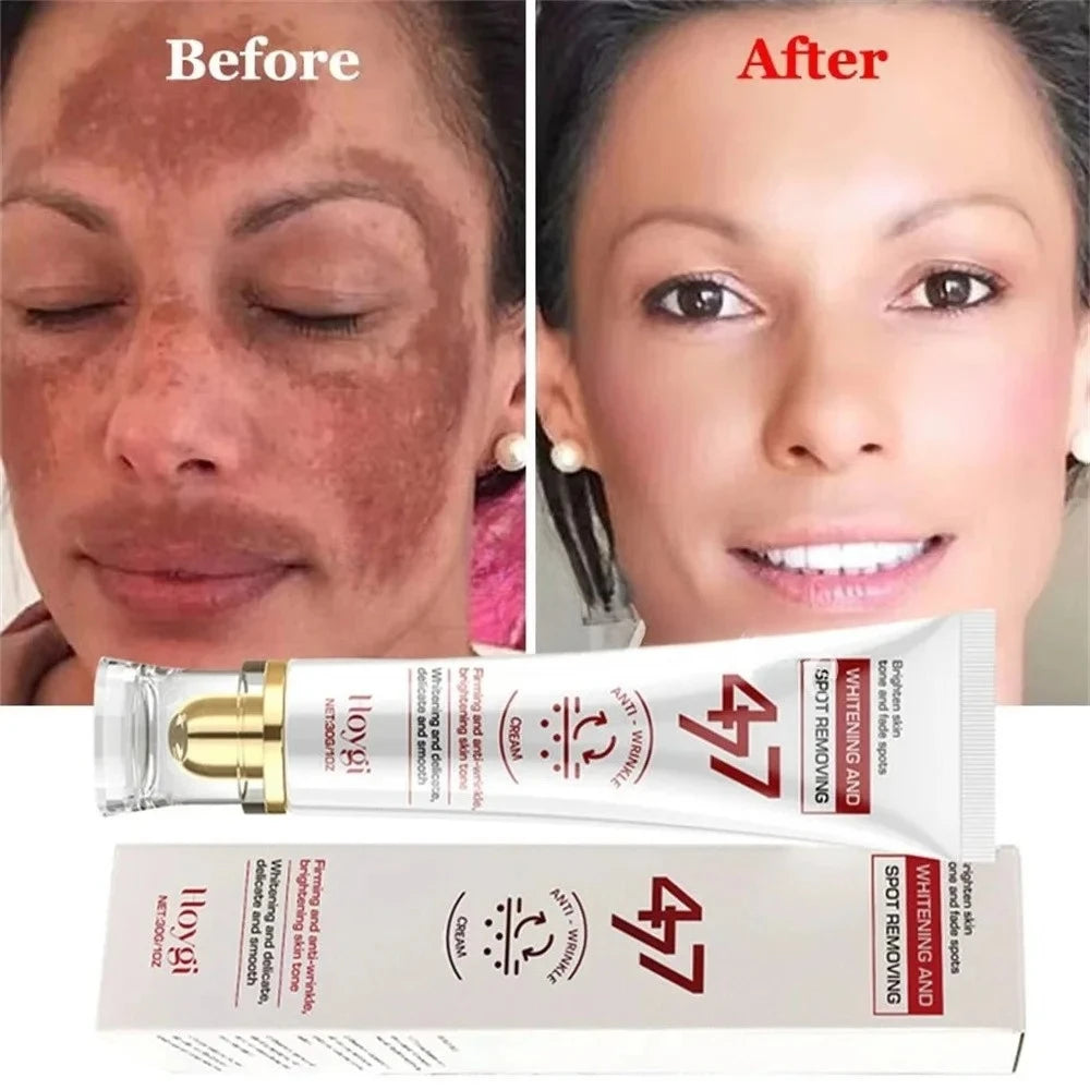 Powerful Spot-Removing Whiten Cream Brighten Skin