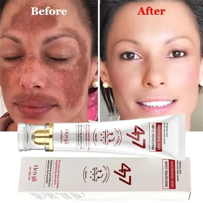 Powerful Spot-Removing Whiten Cream Brighten Skin