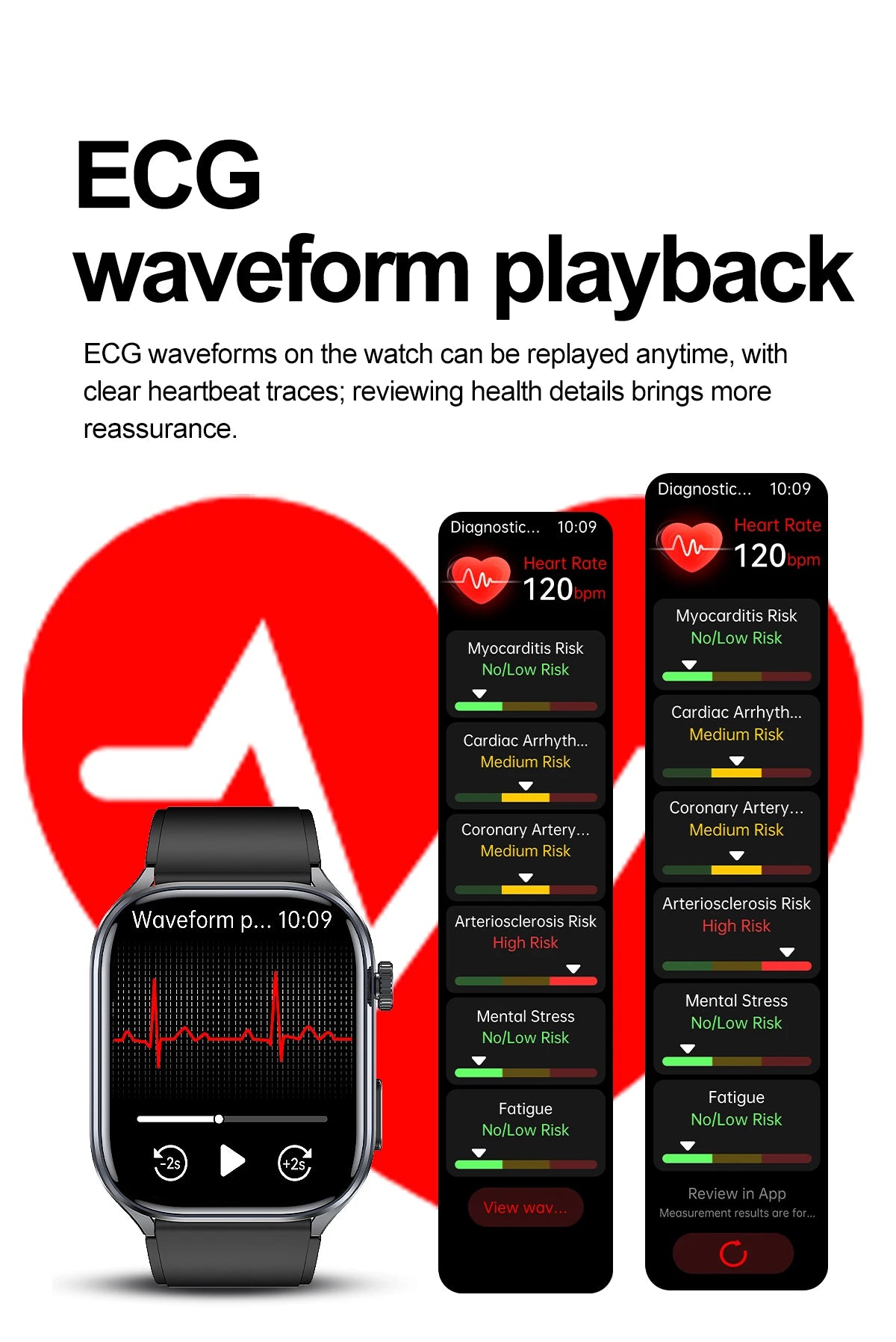 New AI Health Care Accurate detection ECG Smart Watch