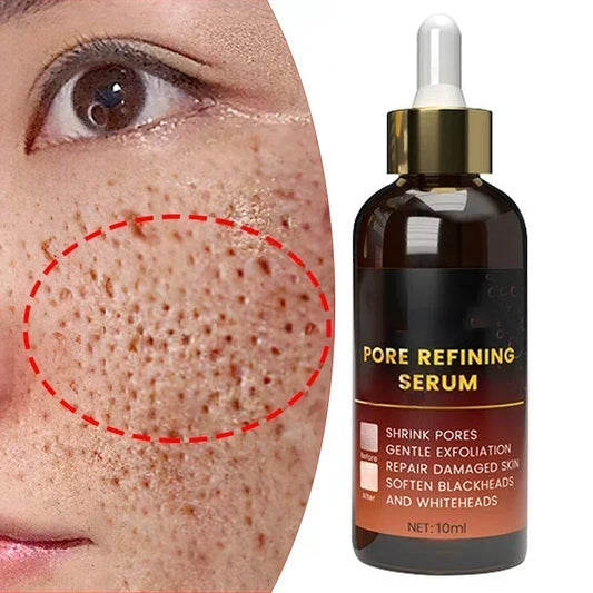 Pore Shrink Face Serum Remove Blackheads Acne Acidity Oil Control
