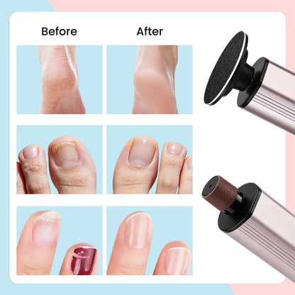 Aluminum Alloy Electric Foot Grinder 9 Speeds Callus
