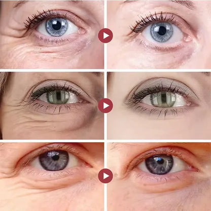 Instant Eye Bag Remove Cream Retinol Anti-Wrinkle Firming Skin Fade