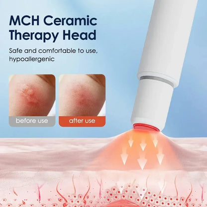 Portable Heat Therapy Anti-Itch Pen Electric Mosquito Bug