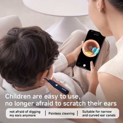 2025 Xiao'm Bebird EarSight Plus I35R Visual Ear Cleaner