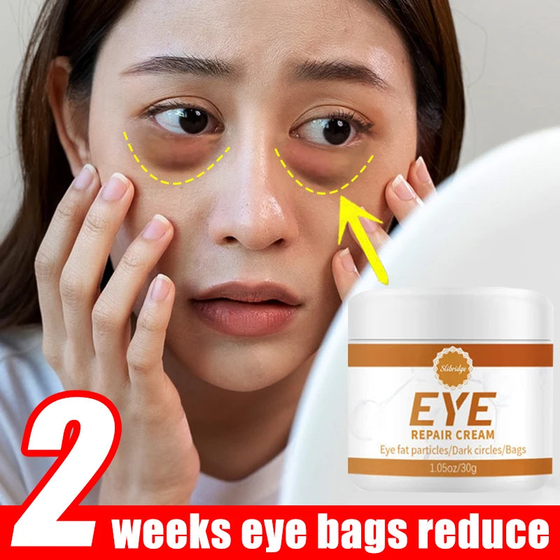 Eye Cream for Dark and Puffy Eyes