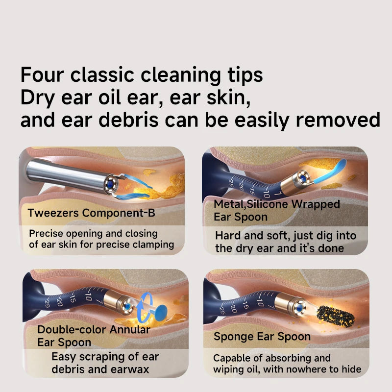 2025 Xiao'm Bebird EarSight Plus I35R Visual Ear Cleaner