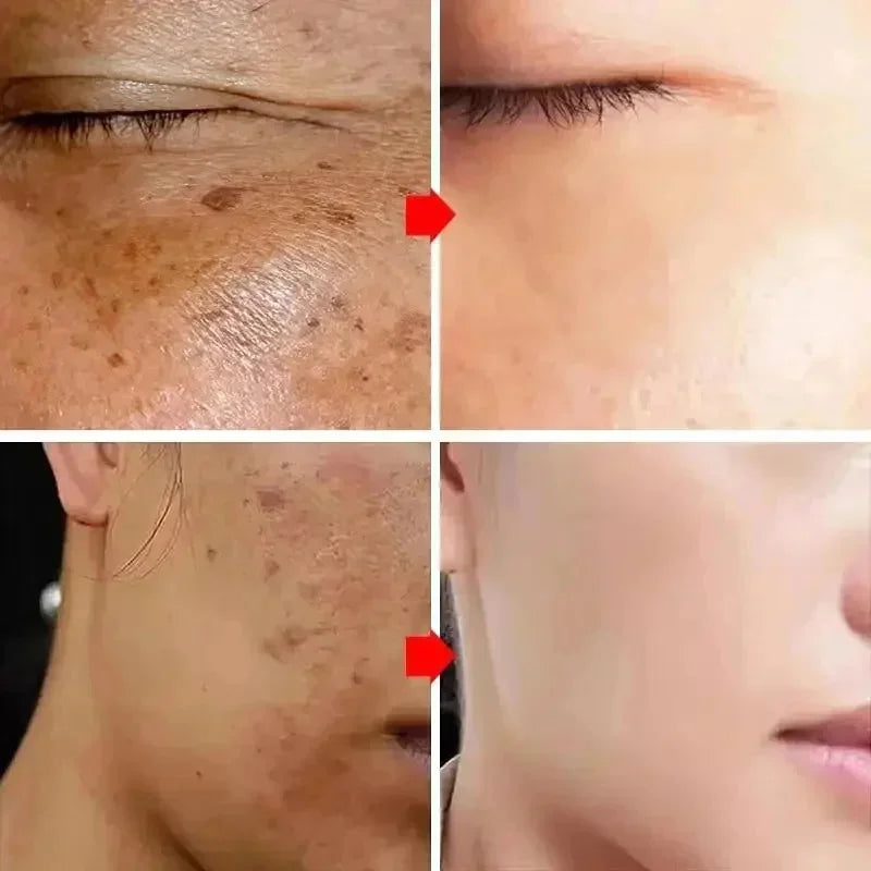 Powerful Spot-Removing Whiten Cream Brighten Skin