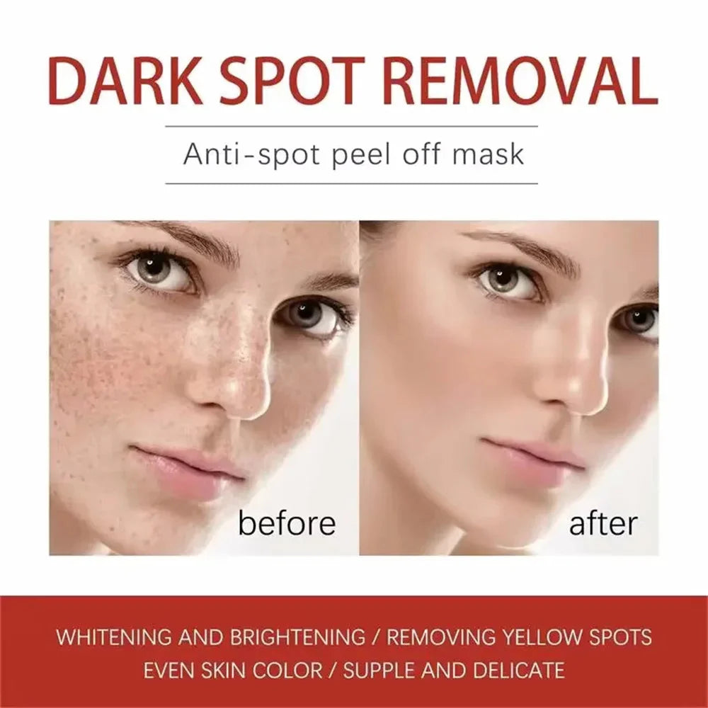 Powerful Spot-Removing Whiten Cream Brighten Skin