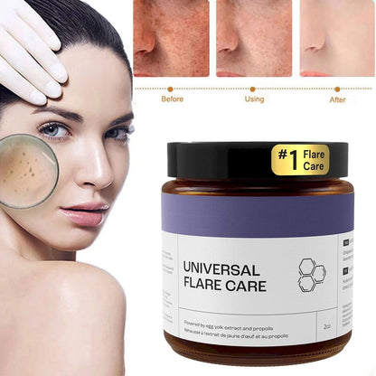 U Niversal | R Elieve Skin Problems | Hidradenitis