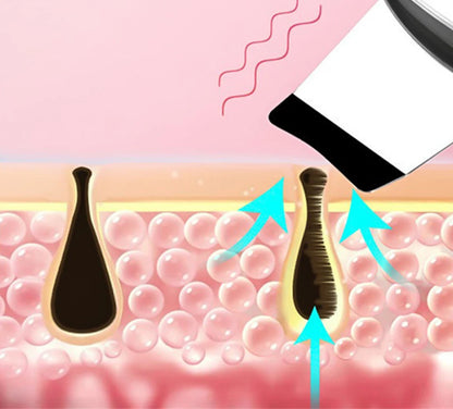Ultrasonic Skin Scrubber Electric Facial Cleansing Pore