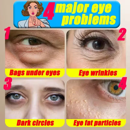 Eye Cream for Dark and Puffy Eyes