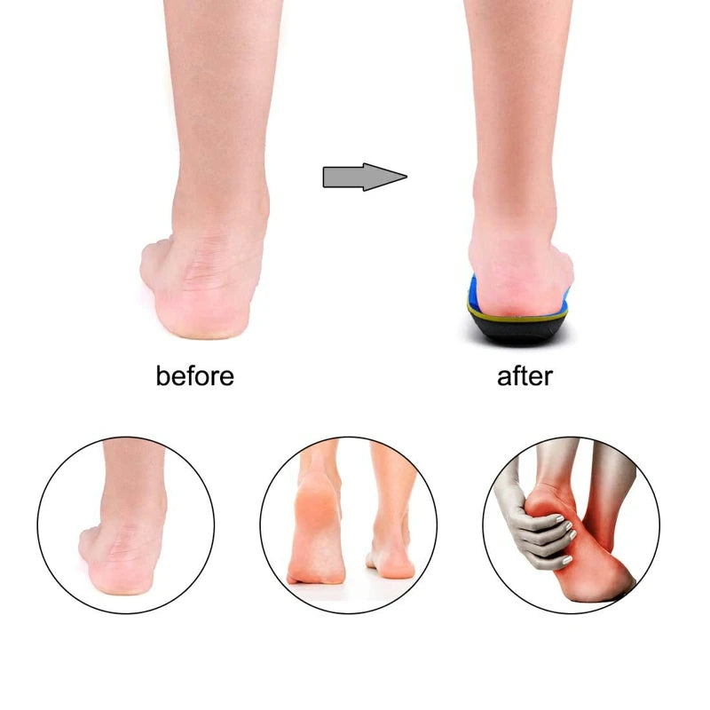 IFITNA Flat Feet Orthopedic Insoles Arch Support