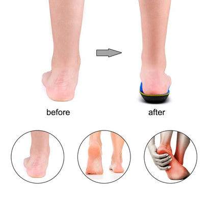 IFITNA Flat Feet Orthopedic Insoles Arch Support
