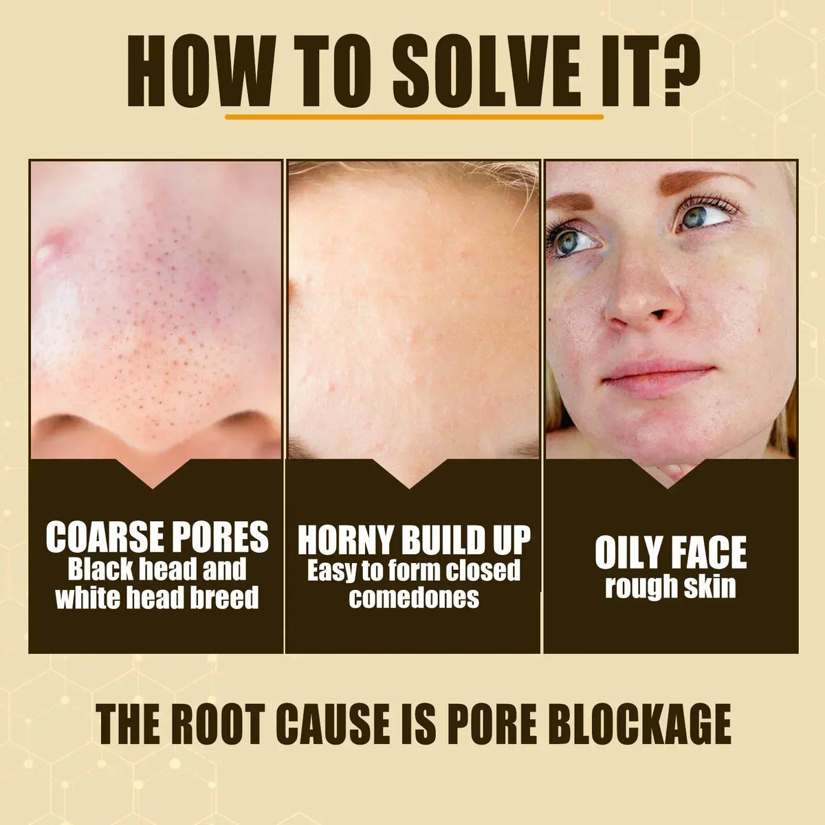 Pore Shrink Face Serum Remove Blackheads Acne Acidity Oil Control