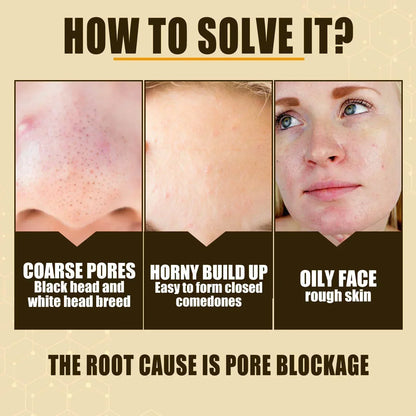 Pore Shrink Face Serum Remove Blackheads Acne Acidity Oil Control