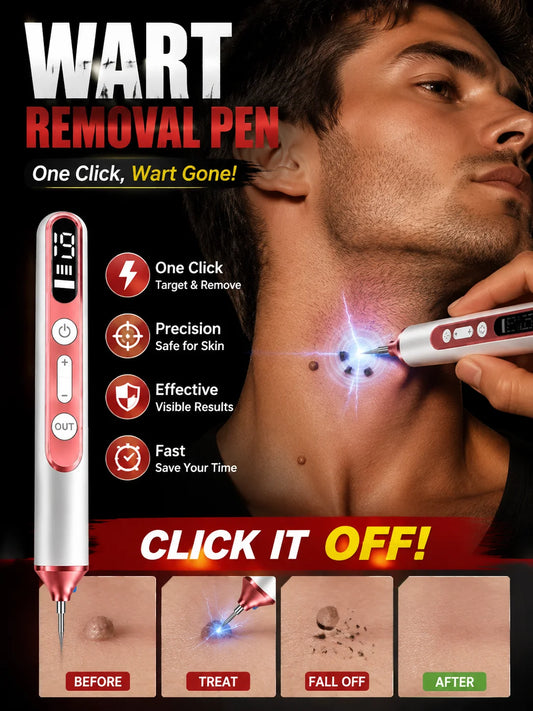 Plasma Pen for Warts Remover Mole Removal Pen Skin Tag