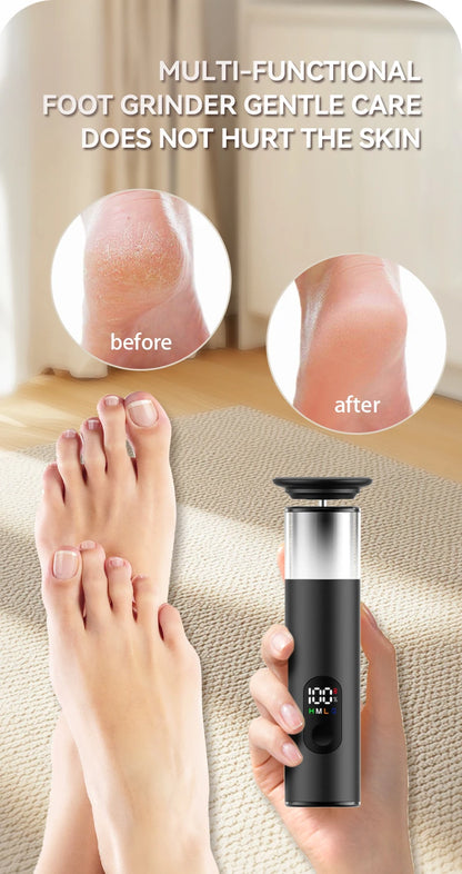Gold 2-in-1 Electric Foot Callus Remover Foot Care