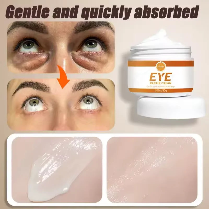 Eye Cream for Dark and Puffy Eyes