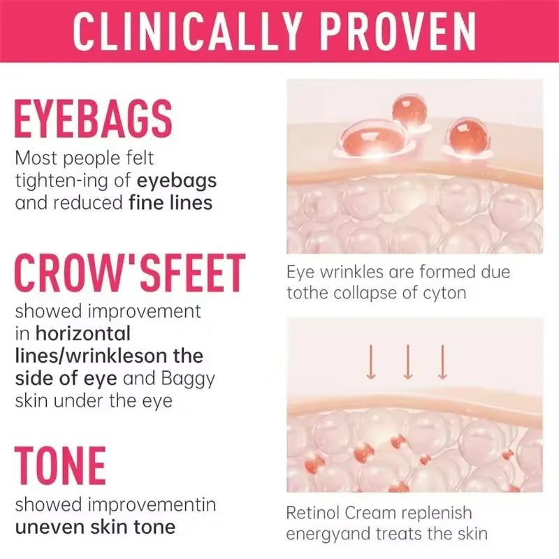 Instant Eye Bag Remove Cream Retinol Anti-Wrinkle Firming Skin Fade