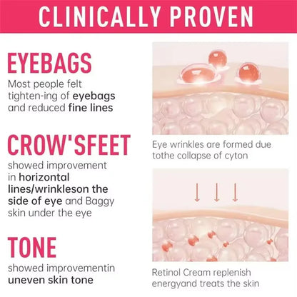 Instant Eye Bag Remove Cream Retinol Anti-Wrinkle Firming Skin Fade
