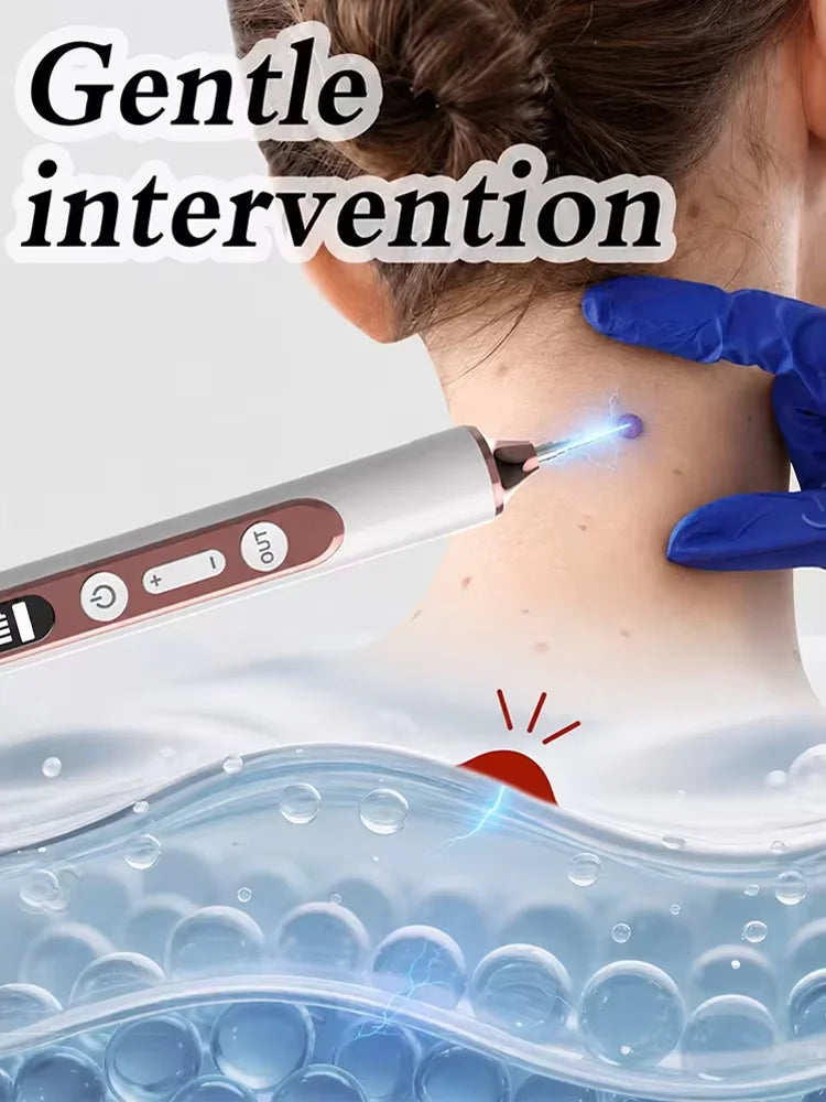 Plasma Pen for Warts Remover Mole Removal Pen Skin Tag
