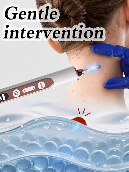 Plasma Pen for Warts Remover Mole Removal Pen Skin Tag