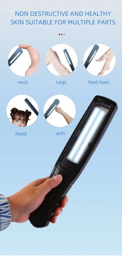 Ultraviolet Phototherapy Instrument Use UVB Lamp