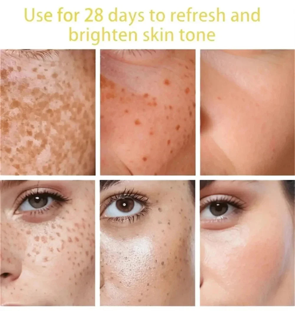 Powerful Spot-Removing Whiten Cream Brighten Skin