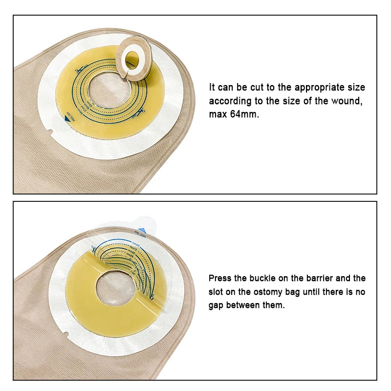 20pcs One Piece Colostomy Bags with Hoop and Look