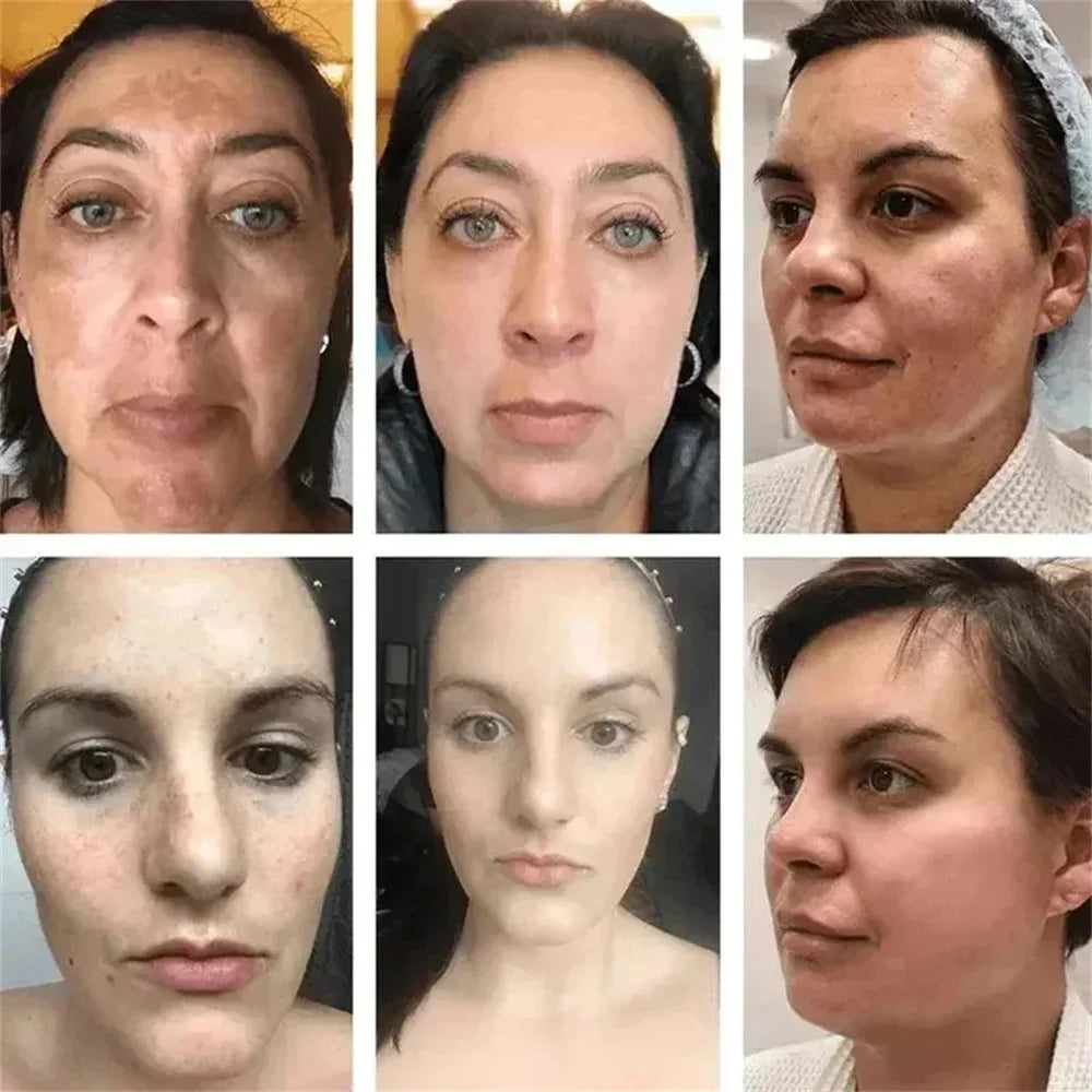 Powerful Spot-Removing Whiten Cream Brighten Skin