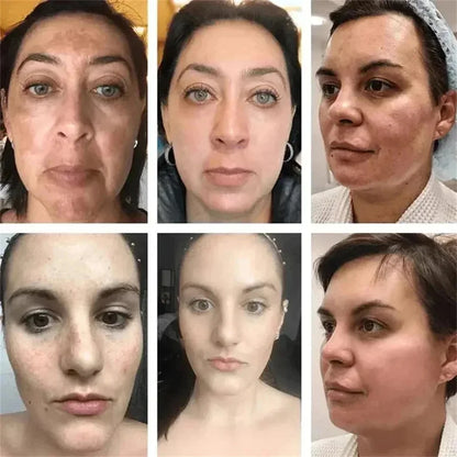Powerful Spot-Removing Whiten Cream Brighten Skin