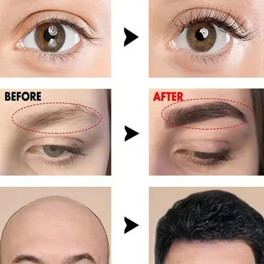 Fast Eyebrow Growth Serum Eyelash Hair Growth Anti Hairs Loss